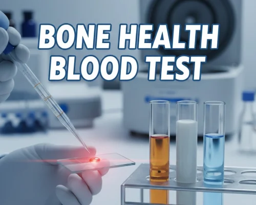 Bone Strength & Density Test Dubai